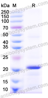 Recombinant Human EIF4A1 Protein, N-His