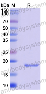 Recombinant Human GMFB Protein, N-His