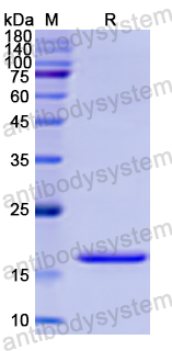 Recombinant Human CD184/CXCR4 Protein, N-His