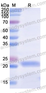 Recombinant Human RAB14 Protein, N-His