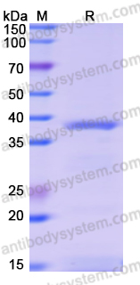 Recombinant Human ATP6V0D1 Protein, N-His