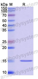 Recombinant Human NPC2 Protein, N-His