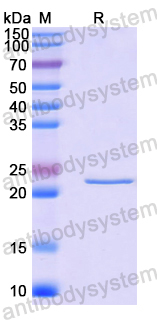 Recombinant Human TIMM10 Protein, N-His-SUMO