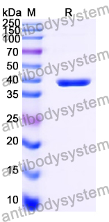 Recombinant Human PPP1CA Protein, N-His