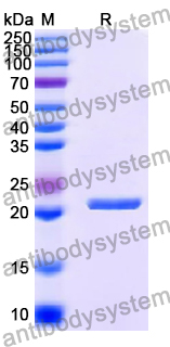 Recombinant Human RPS8 Protein, N-His