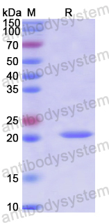 Recombinant Human RPL7A Protein, N-His
