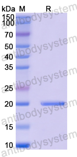 Recombinant Human CNBP Protein, N-His-SUMO