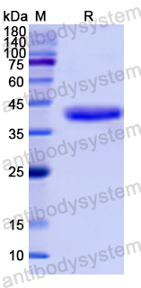 Recombinant Human SMA /ACTA2 Protein, N-His