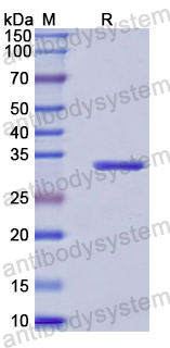 Recombinant Human RBX1 Protein, N-GST & C-His