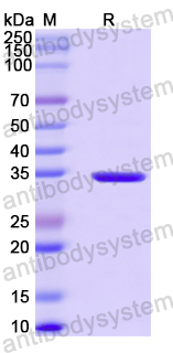Recombinant Human RPL39 Protein, N-GST & C-His