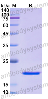 Recombinant Human PPIA Protein, N-His