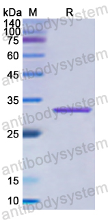 Recombinant Human AP2B1 Protein, N-His