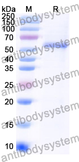 Recombinant Human PPP2R2A Protein, N-His