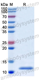 Recombinant Human DYNLL1 Protein, N-His
