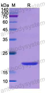 Recombinant Human SKP1 Protein, N-His