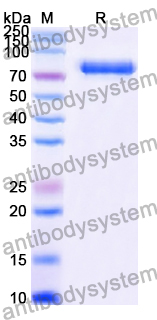 Recombinant Human RACK1 Protein, N-His-MBP