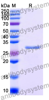 Recombinant Human TPM4 Protein, N-His