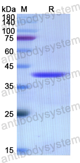 Recombinant Human CD156a/ADAM8 Protein, N-His