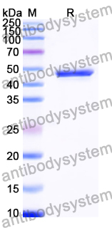 Recombinant Human PIP4K2B/PIP4KII-beta Protein, N-His