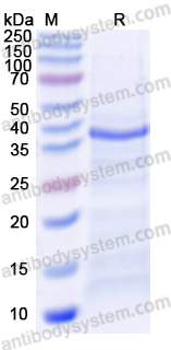 Recombinant Human CTAG1A/NY-ESO-1/LAGE-2 Protein, N-His-SUMO