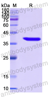 Recombinant Human ABCA4 Protein, N-His