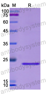 Recombinant Human OLR1 Protein, N-His