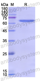Recombinant Human NKX6-1 Protein, N-GST