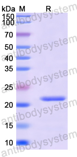 Recombinant Human NKX6-1 Protein, N-His-SUMO