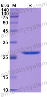 Recombinant Human CD339/JAG1 Protein, N-His