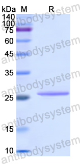 Recombinant Human KCNJ10 Protein, N-His