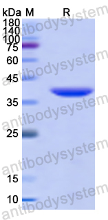 Recombinant Human ARG2 Protein, N-His