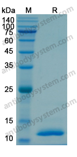 Recombinant Human CCL20/MIP-3-alpha Protein, N-His