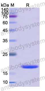 Recombinant Human CRADD Protein, N-His