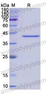Recombinant Human PHEX Protein, N-His