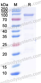 Recombinant Human ADARB1 Protein, N-His