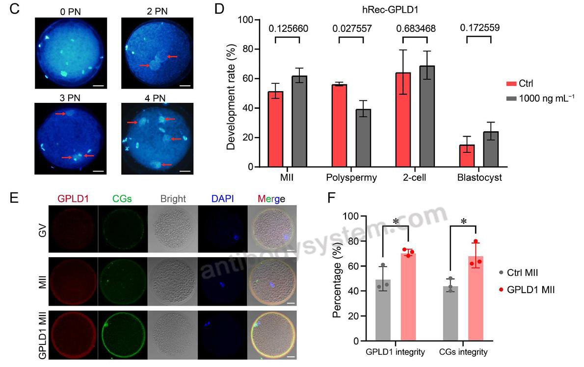 Bioactivity for Recombinant Human GPLD1 Protein, N-His ?>