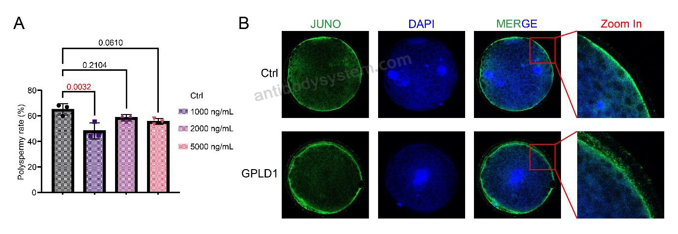 Bioactivity for Recombinant Human GPLD1 Protein, N-His ?>