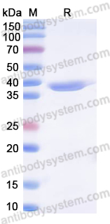 Recombinant Human GPLD1 Protein, N-His