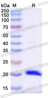 Recombinant Human LCN2 Protein, N-His