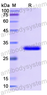 Recombinant Human IFI35 Protein, N-His