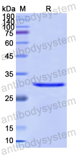 Recombinant Human ABAT Protein, N-His