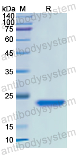 Recombinant Human BASP1 Protein, N-His