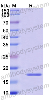 Recombinant Human BASP1 Protein, N-His-SUMO