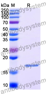 Recombinant Human RPL24 Protein, N-His