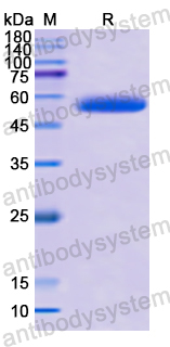 Recombinant Human XIAP Protein, N-His