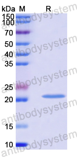 Recombinant Human RBM10 Protein, N-His-SUMO