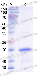Recombinant Human RBM3 Protein, N-His
