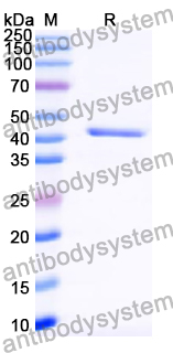 Recombinant Human ATP2C1 Protein, C-His