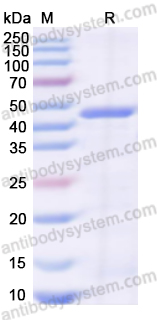Recombinant Human MAT1A Protein, N-His