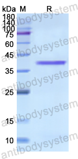 Recombinant Human CDK6 Protein, N-His